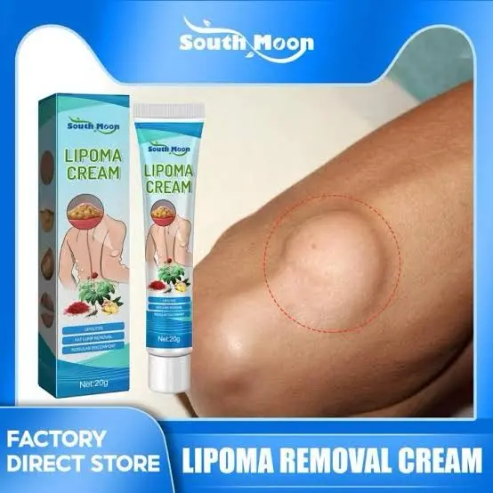 Picture of South Moon Lipoma Removal Cream Lipolysis Fat Lump Relieve Plaster Skin Swelling Ointment Subcutaneous Lumps Dredge Dissipate Body Care（20g）