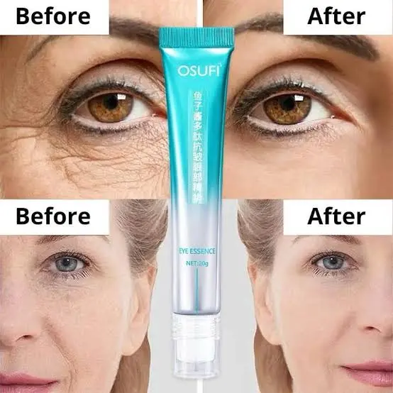 Picture of Osufi Anti Wrinkle Massage Eye Cream Reduces Eye Wrinkles Removes Bags Dark Circles Moisturizes Skin Beauty Health Eye Essen