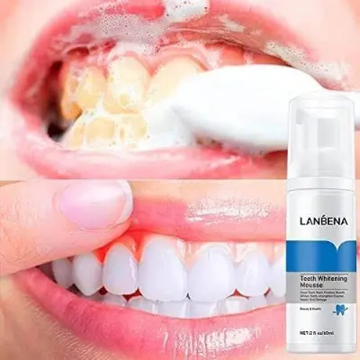 Picture of LANBENA Teeth Whitening Mousse (60ml) Rich & Delicate Foam - Clean Teeth Stain, Freshen Breath, Whiten Teeth, Strengthen Enamel, Repair Oral Damage