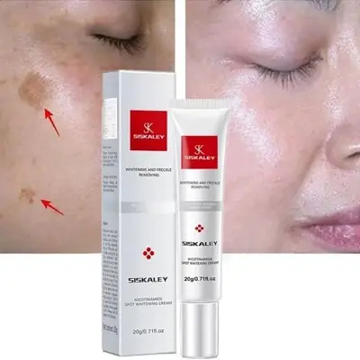 Picture of Youbuy Freckle Whitening Cream 20g Pigmentation Remover Dark Spot Remover Anti Freckles Whitening Cream