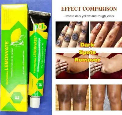 Picture of Lemonvate Cream - 30gm (Italy)