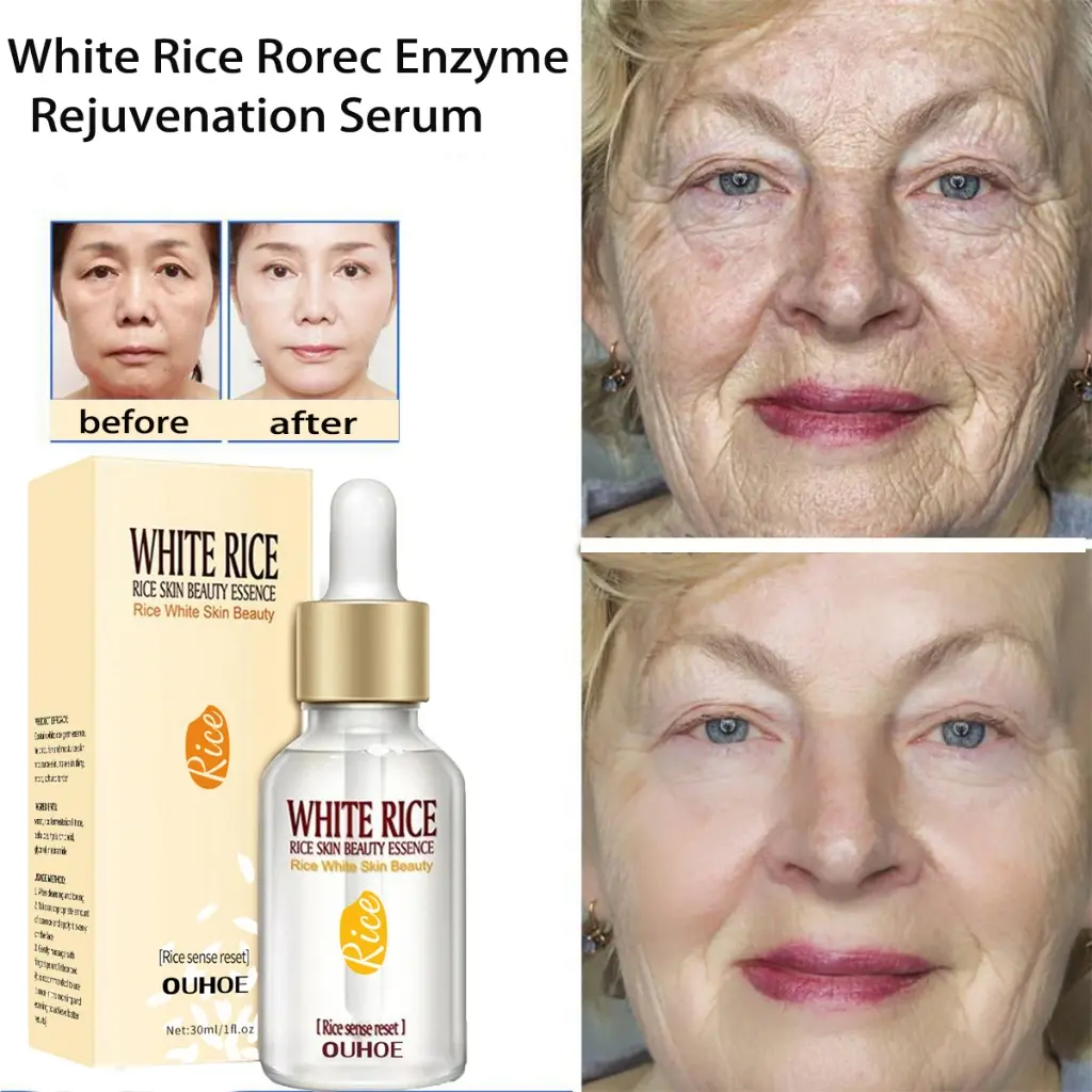 Picture of ROREC White Rice Serum Reduces Wrinkles and Lighten Dark Spots Pore Minimizer Anti- Aging Face Moisturizer Skin Lightening - 15ml