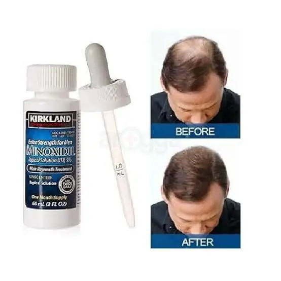 Picture of Kirkland Minoxidil 5% Topical Solution 60ml Extra Strength Hair Regrowth Treatment for Men Dropper Applicator Included