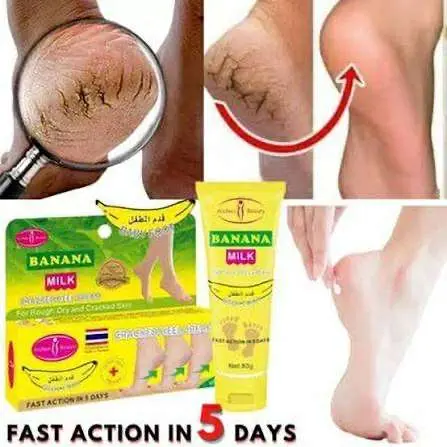 Picture of Picture of AICHUN BEAUTY 80gm Cracked Heel Cream Foot Care Banana Milk Cream Rough Dry Skin Baby Foot Picture of AICHUN BEAUTY 80gm Cracked Heel Cream Foot Care Banana Milk Cream Rough Dry Skin Baby Foot AICHUN BEAUTY 80gm Cracked Heel Cream Foot Care Ban