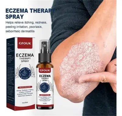 Picture of Psoriasis Relief Spray, Psoriasis Spray 2pcs Repair Skin Portable For Eczema For Skin Itch