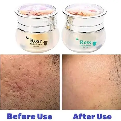 Picture of Feique Rose Essence Anti-freck Day and Night Cream