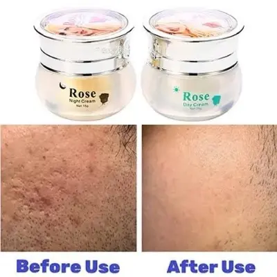 Picture of Feique Rose Essence Anti-freck Day and Night Cream