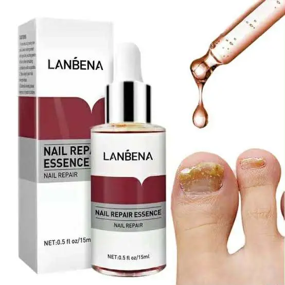 Picture of LANBENA Nail Repair Essence Serum Fungus Treatment Nail Removal Onychomycosis-15ml