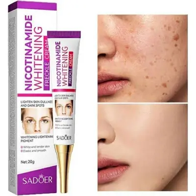 Picture of SADOER Niacinamide Whitening Freckle Cream Effectively Removes Melasma Lightens Black Spots Acne Marks Brightens Skin Care-20gm
