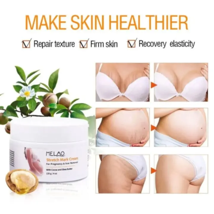 Picture of MELAO Women Remove Pregnancy Scars Acne Cream Stretch Marks Treatment Maternity Repair Anti-Aging Body Creams-120gm