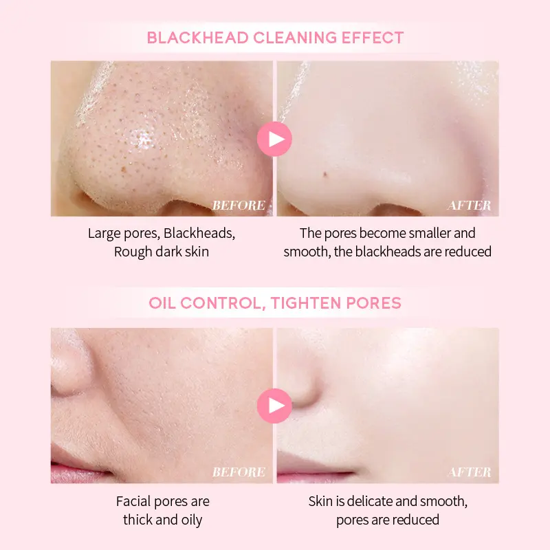 Picture of LAIKOU Japan Sakura Hydrating Pores Cleaning Mud Mask- 75g
