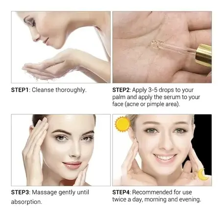 Picture of Breylee Acne Treatment Serum- 17ml