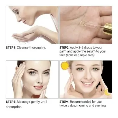 Picture of Breylee Acne Treatment Serum- 17ml
