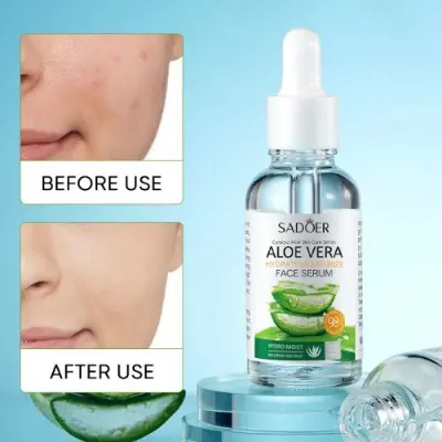 Picture of SADOER Aloe Vera Soothing Moisture & Brighter Face Luxurious Hydrating Essence- 30ml(Aloe Vera)
