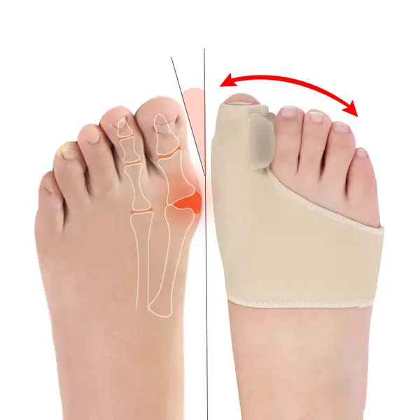 Picture of SEBS toe flip corretor day and night orthopedic orthopeder, large foot bone toe overtopo corrector toe- 1 Pair