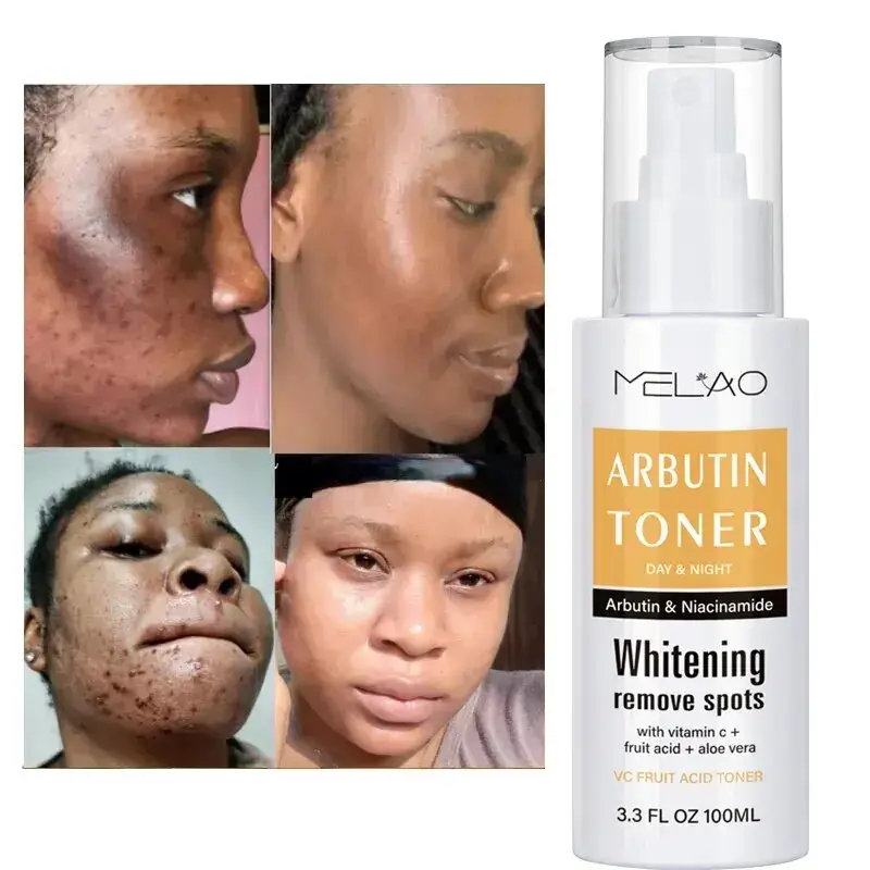 Picture of Melao Moisturizing Mist Vitamin C Whitening Arbutin Toner- & Spots Remover