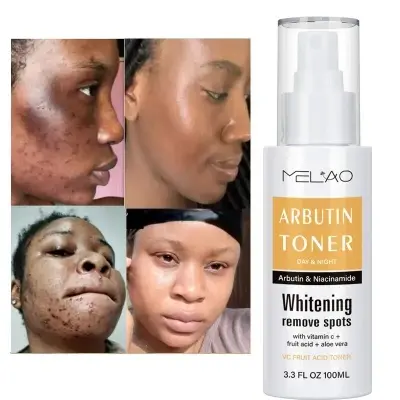 Picture of Melao Moisturizing Mist Vitamin C Whitening Arbutin Toner- & Spots Remover