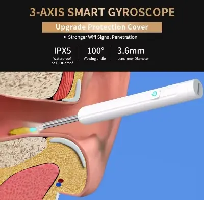 Picture of Smart Visual intelligent Ear Cleaner earpick NE series High Precision Ear Wax Removal beauty Tool with Camera LED Light Wireless Otoscope Smart Ear Cleaning Kit