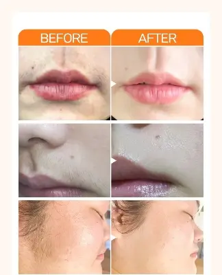 Picture of Wax Painless Hair Remover Ladies Epilator Cream Skin Care Lip Underarm Private Bikini Body Beauty Face Depilation Hair Removal Multicolor