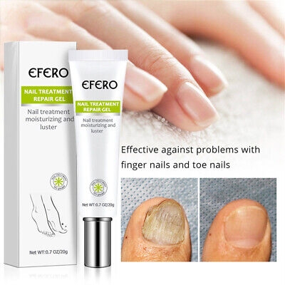 Picture of Efero Nail Repair Treatment Gel Fungus Cream-20gm
