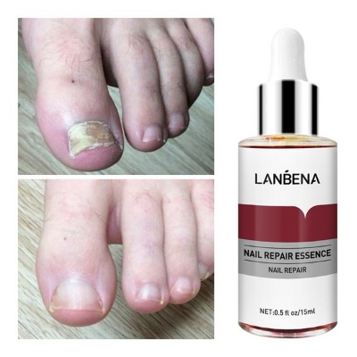 Picture of LANBENA Nail Repair Essence Serum - 12ml