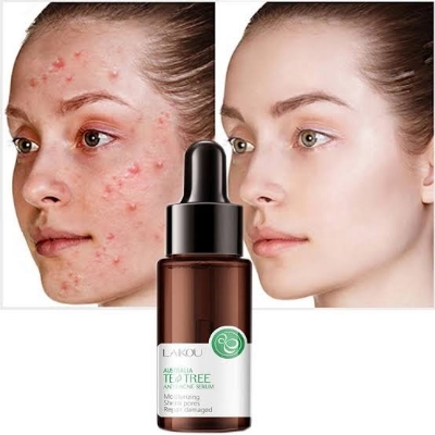 Picture of Laikou australia Tea tree Acne Treatment Brightening Moisturizing Oil-control anti-acne serum-17ml