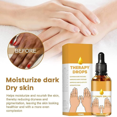 Picture of JAYSUING NigriCare Therapy Drops, Acanthosis Nigricans Dark Spot Corrector Oil-10ml