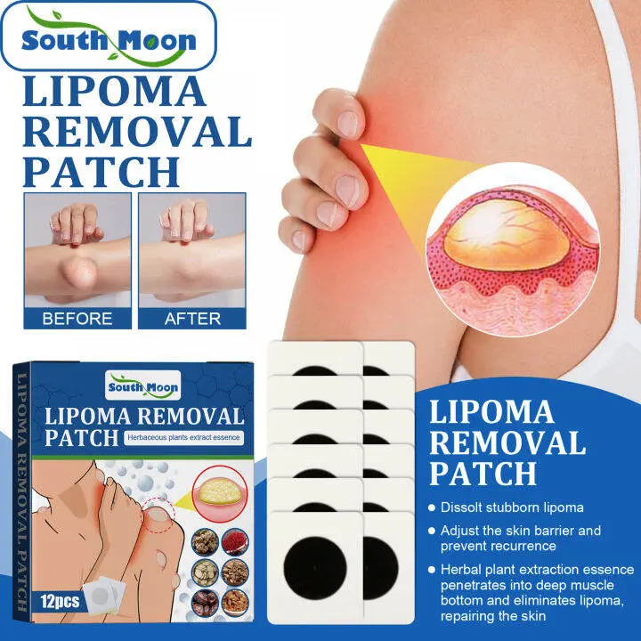 Picture of South Moon Lipoma Removal Cream Lipolysis Fat Lump Relieve Plaster Skin Swelling Ointment Subcutaneous Lumps Dredge Dissipate Body Care（20g）
