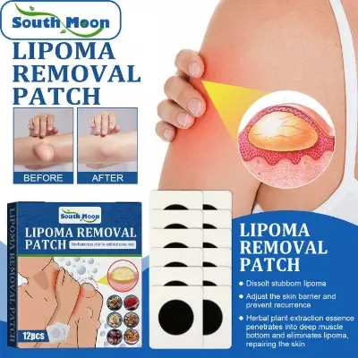 Picture of South Moon Lipoma Removal Cream Lipolysis Fat Lump Relieve Plaster Skin Swelling Ointment Subcutaneous Lumps Dredge Dissipate Body Care（20g）
