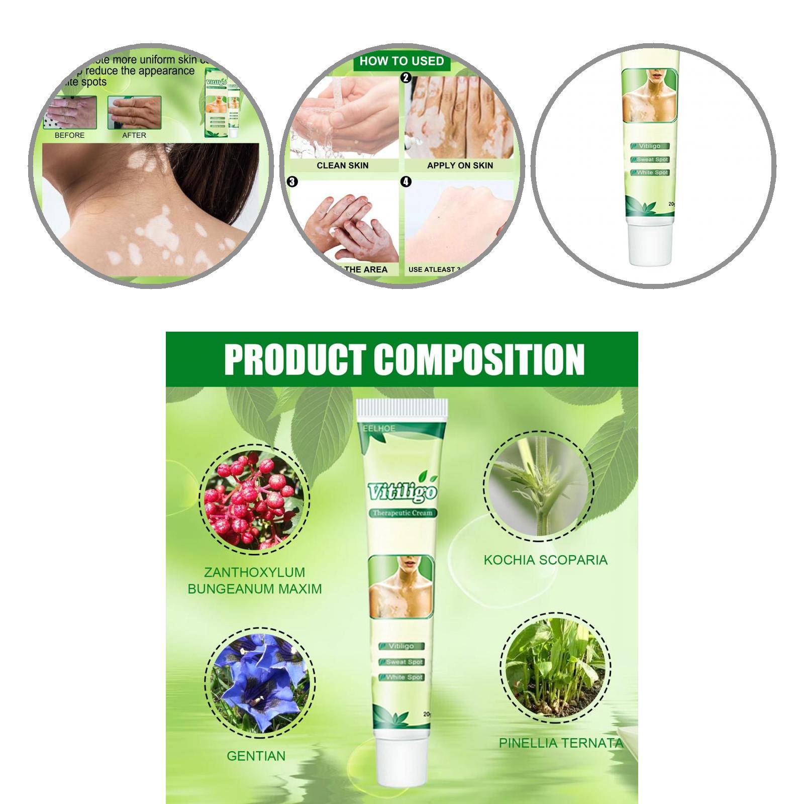 Picture of Vitiligo Treatment Cream Healthy White Spot Therapeutic Gel