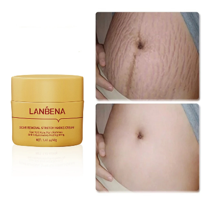 Picture of LANBENA Acne Scar Removal Cream Repair Acne Spots Acne Treatment Blackhead Whitening Shrink Pores Stretch Marks Skin Care 40g
