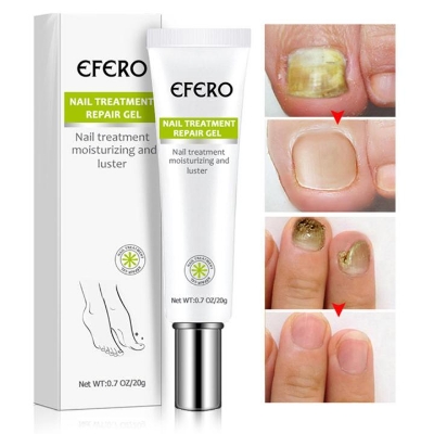 Picture of Efero Nail Repair Treatment Gel Fungus Cream-20gm