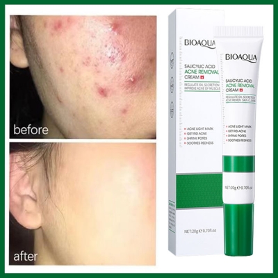 Picture of BIOAQUA Natural Salicylic Acid for Acne Face Cream Cleaning Pores Repairing Acne Spots Controlling Moisturizing Skin Remove Acne Marks-20gm