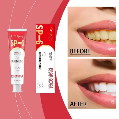 Picture of Oralhoe SP-6 Super Probiotic Bright White Toothpaste - 120g/4.23oz