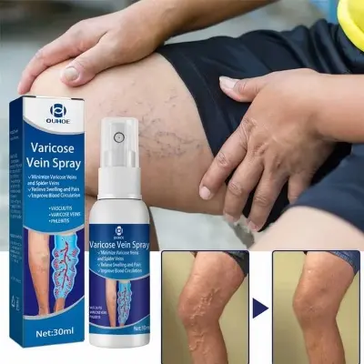 Picture of Varicose Veins Spray Medicine Spider Veins Relief Vasculitis Phlebitis Spider Pain Relief Plaster Care 30ml