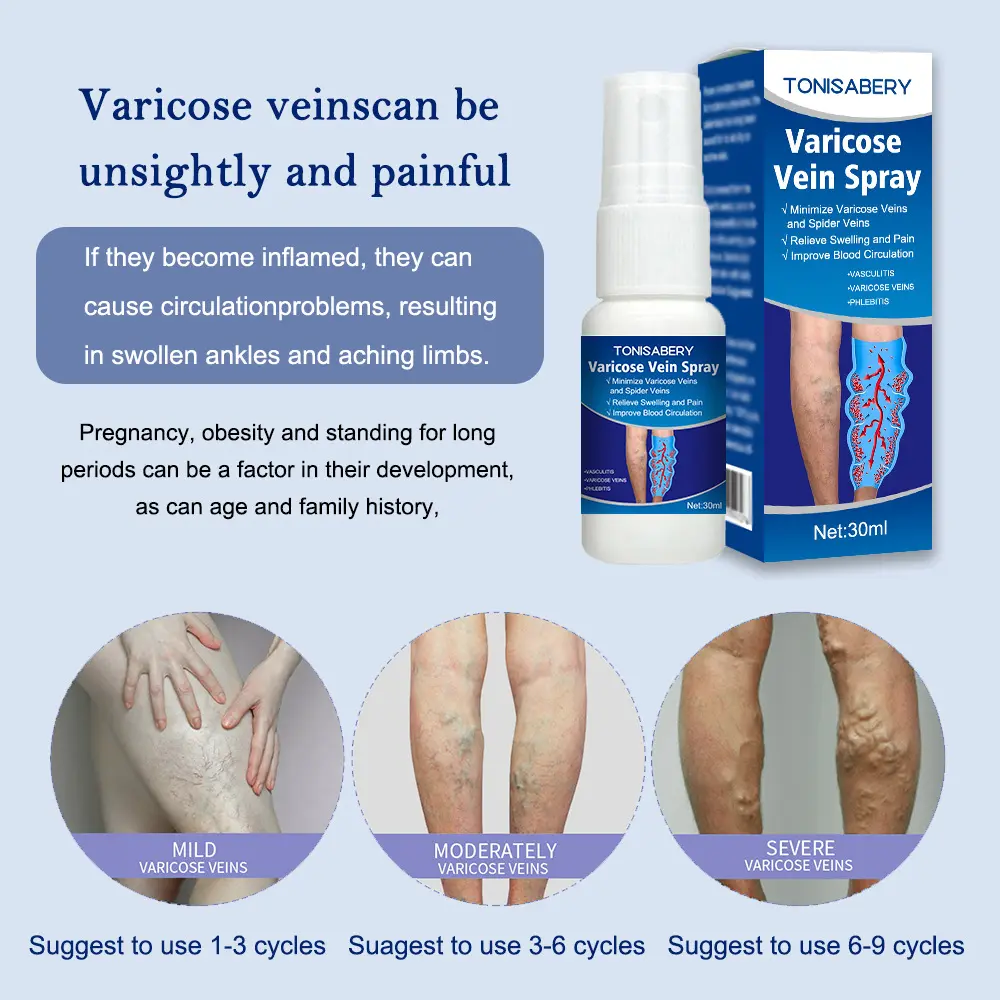Picture of Varicose Veins Spray Medicine Spider Veins Relief Vasculitis Phlebitis Spider Pain Relief Plaster Care 30ml
