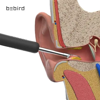 Picture of Bebird Smart Earwax Removal Tool R1 - Black 