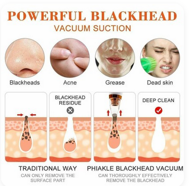 Picture of Multifunctional Cleaning Instrument, Electric Blackhead Remover Machine Vacuum Acne Cleaner Pore Remove Facial Skin Cleanser Care Multifunctional Cleaning Instrument, Blackhead Remover Multifunctional Cleaning Instrument - Multicolor