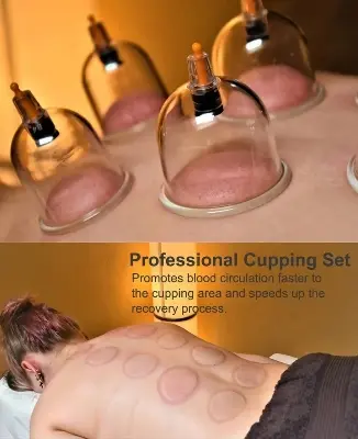 Picture of 12 Cups Vacuum Cuppers Fire Cupping Vacuum Massage Suction Cup Body Care Set