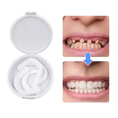 Picture of Silicone Denture Reline Kit Soft Comfortable And Firm Denture Silicone Reline Kit Instant Safe And Durable Instant Teeth