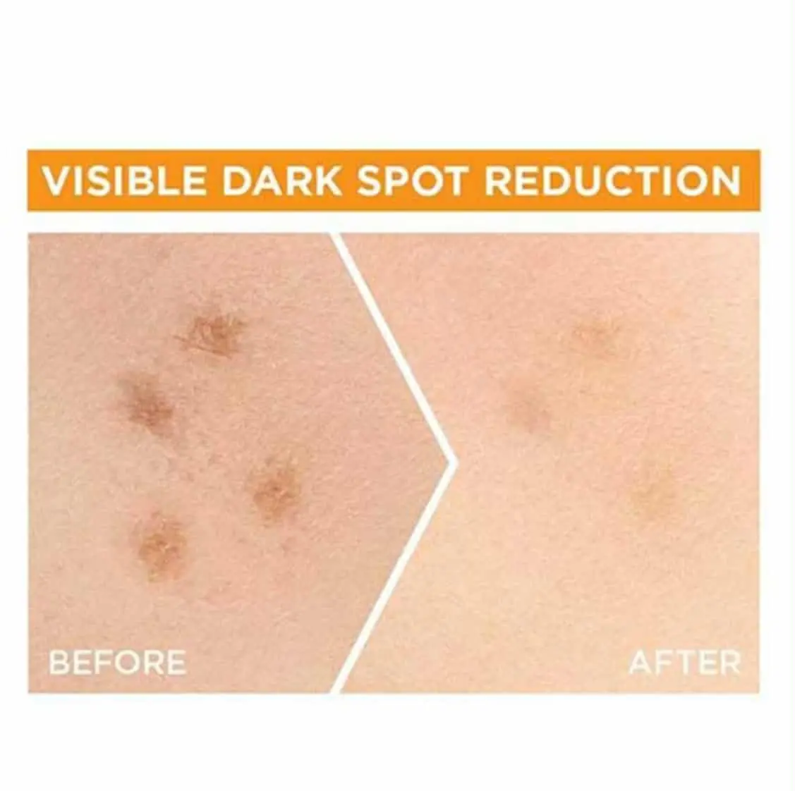 Picture of Garnier Bright Complete Vitamin C Serum 15ml - Face Serum