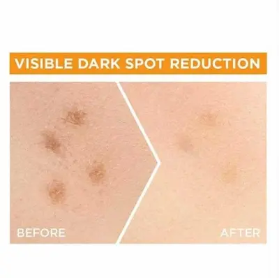 Picture of Garnier Bright Complete Vitamin C Serum 15ml - Face Serum