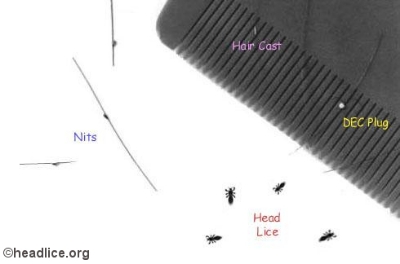 Picture of 2 pieces  Lice Removal Comb Combo  - Best for Ladies Girls Hair lice removal  (Hair Brush) -Multicolor