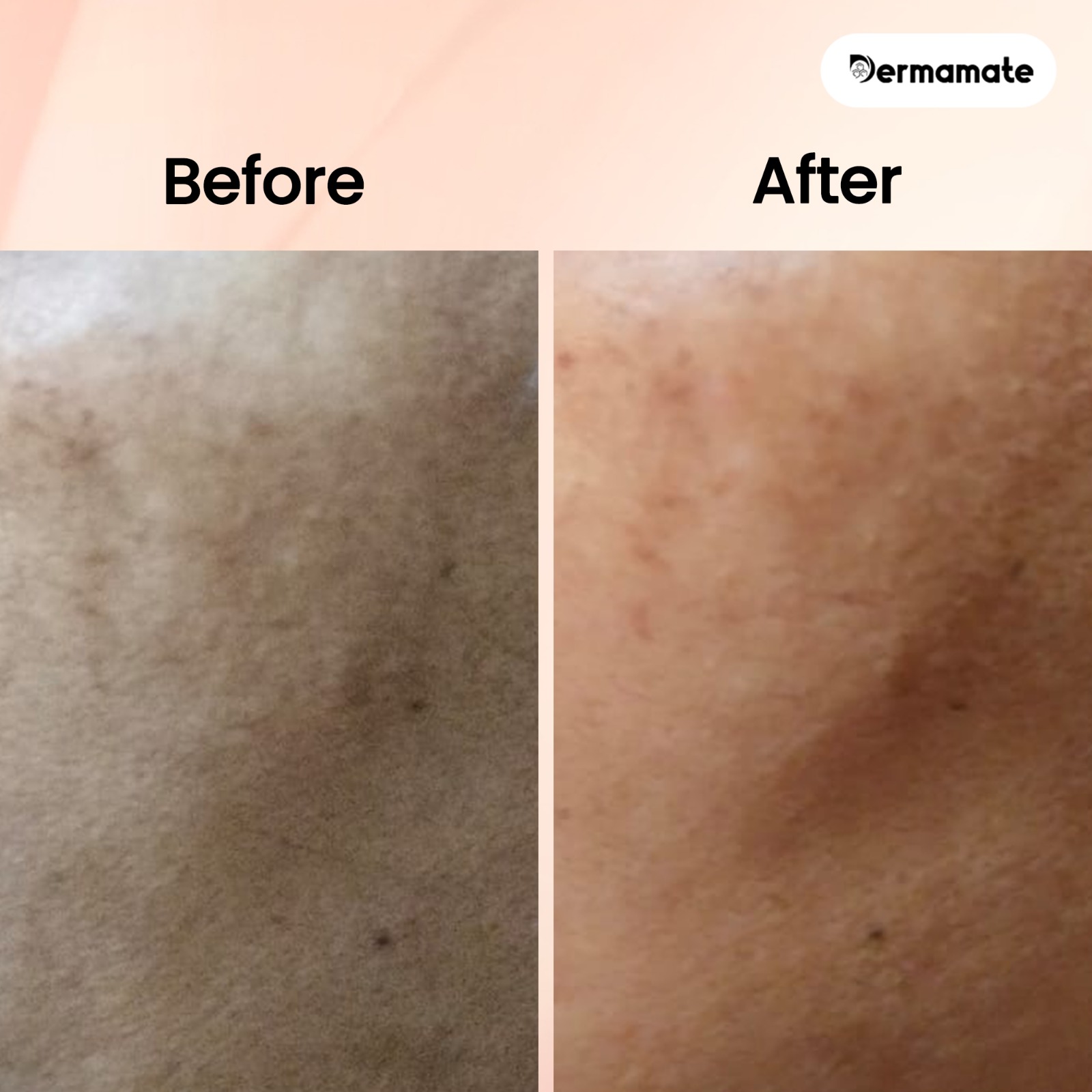 Picture of Dermamate Night Care Face Cream 25gm 