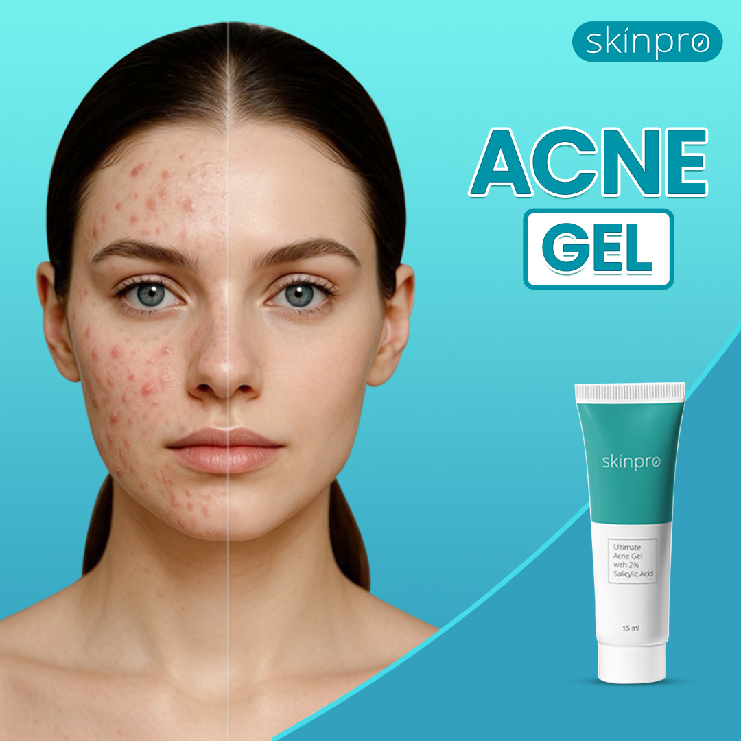 Picture of Buy Skinpro ultimate acne Gel 15ml White