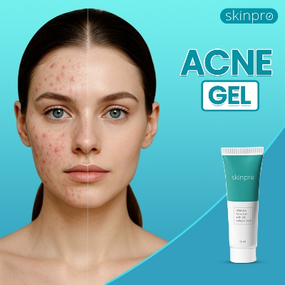 Picture of Skinpro Acne Clearing Gel Cleanser 50 ml and Skinpro Ultimate Acne Gel 15 ml Combo Blue