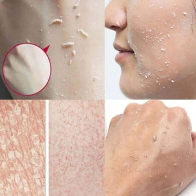 Picture of Papaya Exfoliating Gel