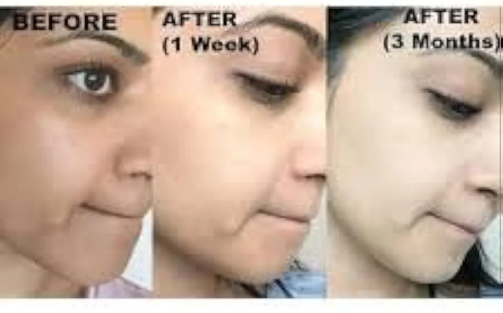 Picture of WHITENING FROZEN COLLAGEN AND MILK  COMBO SET