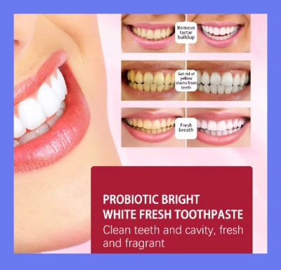 Picture of Yayashi sp-4 Probiotic Toothpaste freshen breath maintain oral health whiten teeth Stain Removing Sp-4 Toothpaste Teeth Cleaner Plaque Remove 