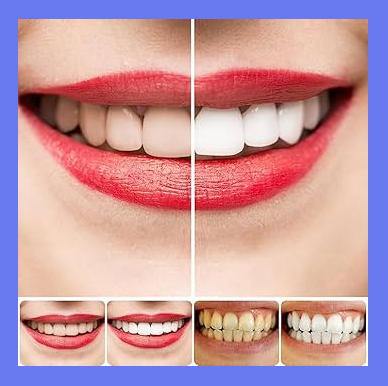 Picture of Yayashi sp-4 Probiotic Toothpaste freshen breath maintain oral health whiten teeth Stain Removing Sp-4 Toothpaste Teeth Cleaner Plaque Remove 